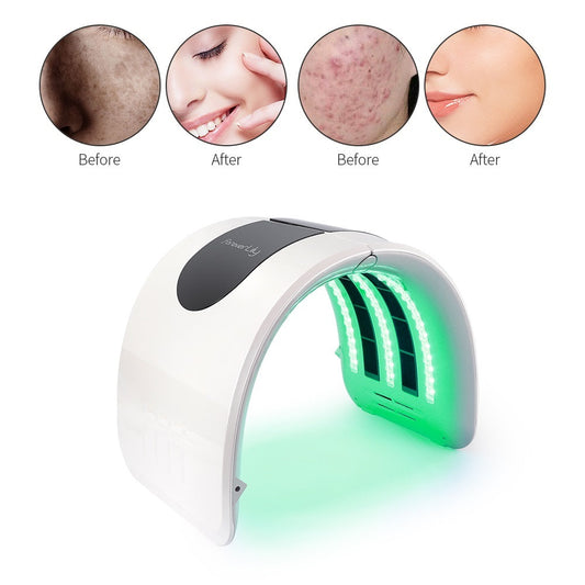 HKM-438035 Photon Skin Rejuvenation Spectrometer with Heating and Color Light Functionality for Home Use