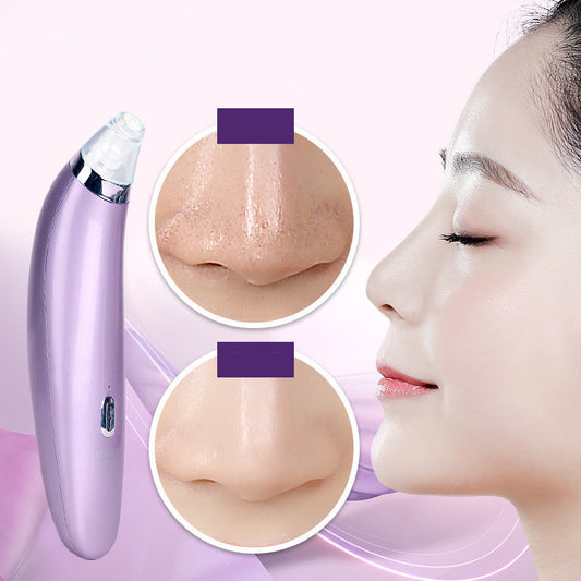 HKM-514451 Electric Blackhead Remover with Rotating Suction Function - Facial Cleansing Tool 180mm x 40mm