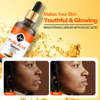 HKM-784403 4-in-1 Kojic Acid Face Serum with Niacinamide, Arbutin, Vitamin C, and Squalane for Dark Spot Correction