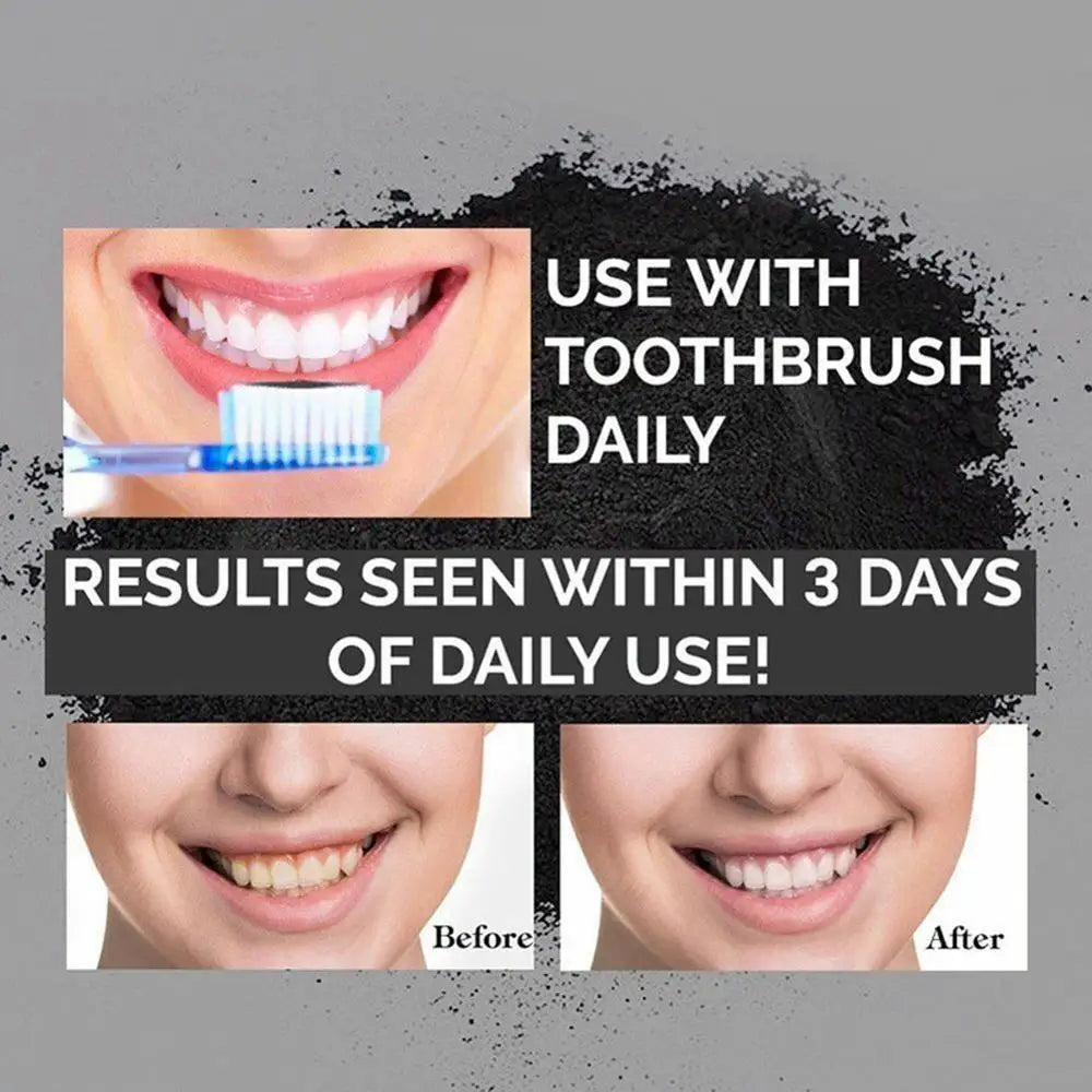 HKM-831827 Natural Activated Charcoal Teeth Whitening Powder 30g for Oral Care and Stain Removal