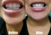 HKM-831827 Natural Activated Charcoal Teeth Whitening Powder 30g for Oral Care and Stain Removal