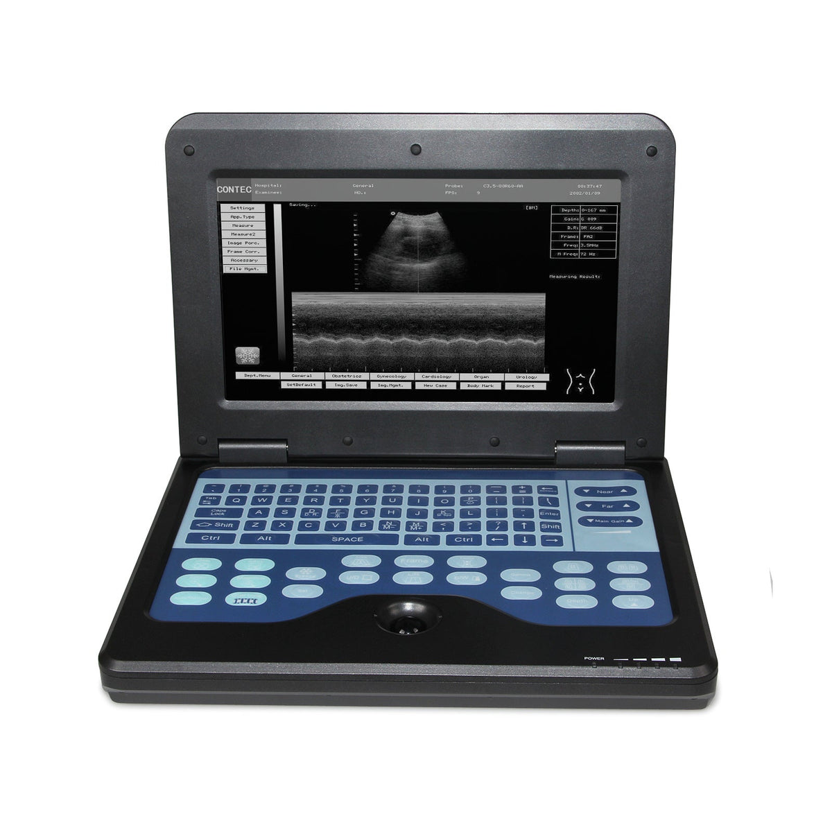 HKM-184723 Portable Digital Ultrasound Scanner with 3.5 Convex Probe for Comprehensive Diagnostic Imaging