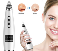 HKM-476179 Electric Blackhead Remover and Facial Pore Cleaner