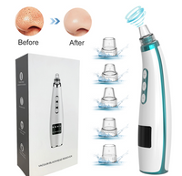 HKM-476179 Electric Blackhead Remover and Facial Pore Cleaner