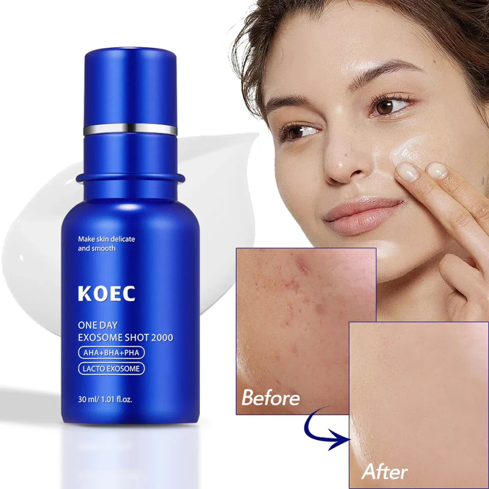 HKM-915475 One Day Zero Exosome Shot Pore Care Skin Serum for Moisturised and Refined Skin