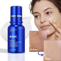 HKM-915475 One Day Zero Exosome Shot Pore Care Skin Serum for Moisturised and Refined Skin