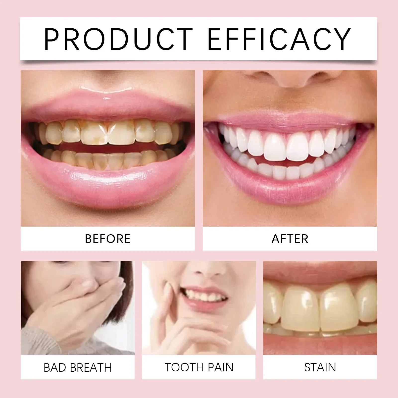 HKM-864595 Probiotic Whitening Toothpaste for Brightening, Gum Protection, and Fresh Breath