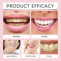 HKM-864595 Probiotic Whitening Toothpaste for Brightening, Gum Protection, and Fresh Breath