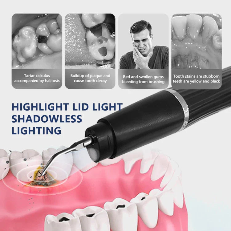 HKM-519955 Ultrasonic Tooth Cleaner Electric Plaque and Tartar Remover Teeth Whitening Kit