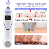 HKM-129619 Hot and Cold Suction Blackhead Remover with Cooling and Heating Functions