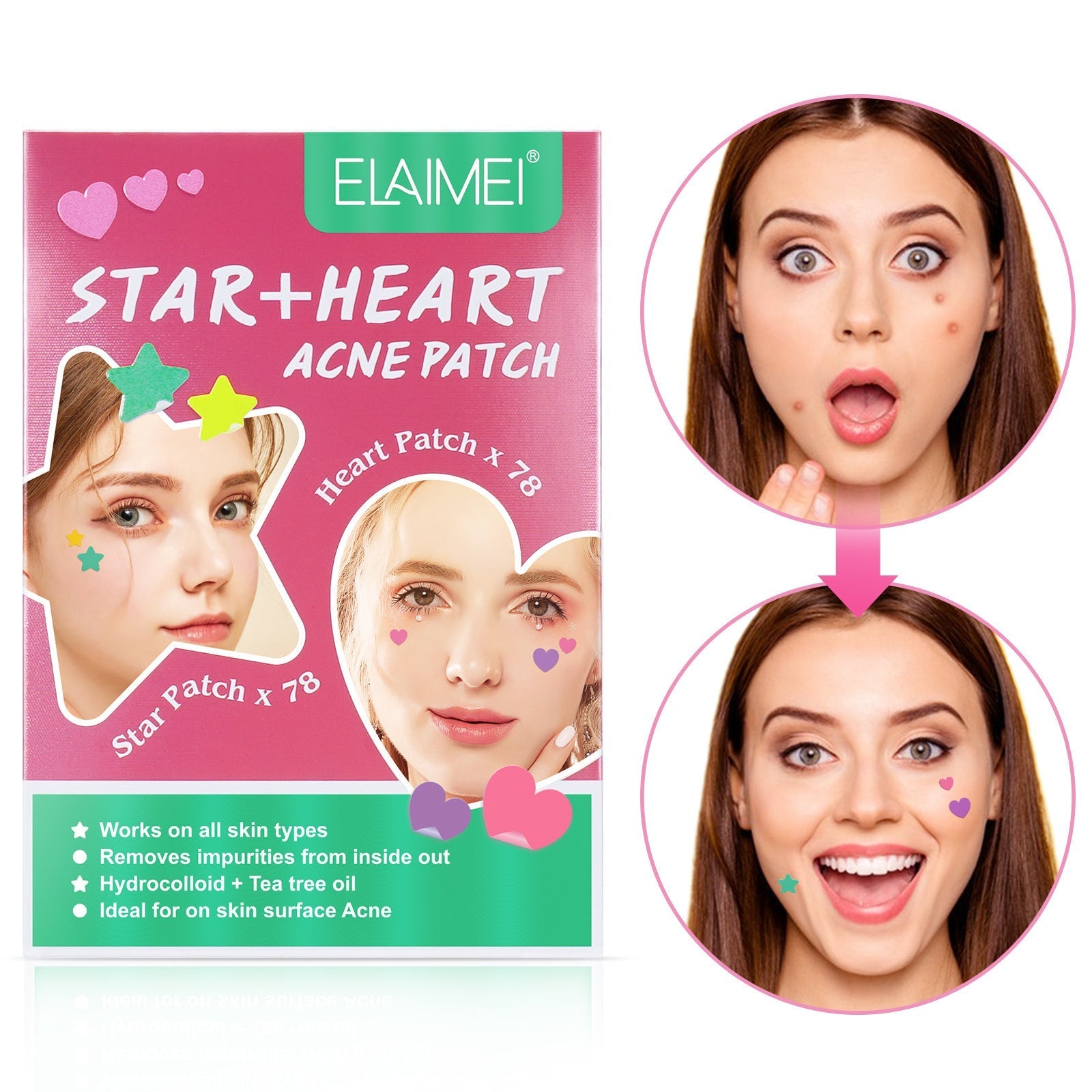 HKM-843283 Multi-Shape Acne Patches for Effective Spot Treatment – Suitable for All Skin Types