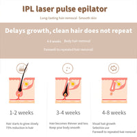 HKM-442643 IPL Laser Hair Removal Device with LCD Display and 5 Energy Levels - 990,000 Pulses