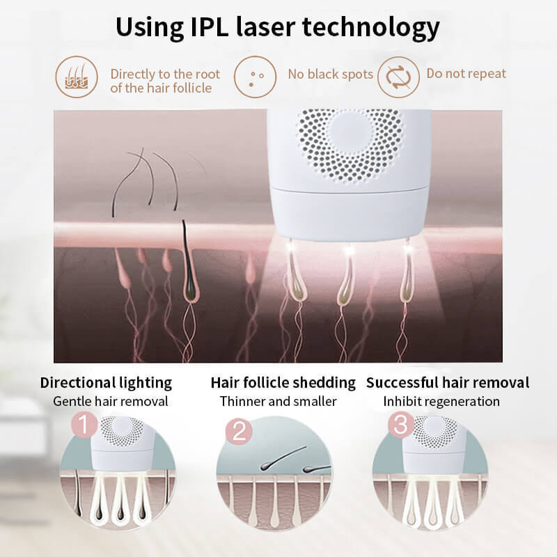 HKM-442643 IPL Laser Hair Removal Device with LCD Display and 5 Energy Levels - 990,000 Pulses