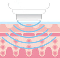 HKM-310419 5-in-1 Rechargeable Ultrasonic Skin Rejuvenation Device for Facial Massage and Treatment