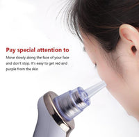 HKM-677971 Electric Blackhead Remover with 5 Suction Heads, Acne Treatment & Skin Rejuvenation Device