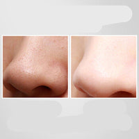 HKM-064083 Ultrasonic Pore Cleaner & Blackhead Remover with Red and Blue Light Therapy