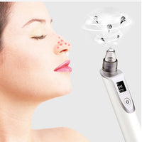 HKM-931859 Ultrasonic Blackhead Removal Device with Infrared Light and Multi-Function Features
