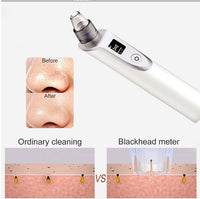 HKM-931859 Ultrasonic Blackhead Removal Device with Infrared Light and Multi-Function Features