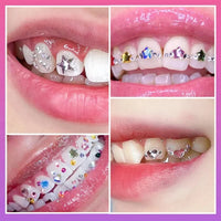 HKM-506451 Tooth Gem Kit with Elegant Gold Gems for Dazzling Smile Creations