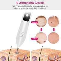 HKM-694099 2-Piece Skin Tag Repair Kit with Adjustable Intensity and Fast Healing Function