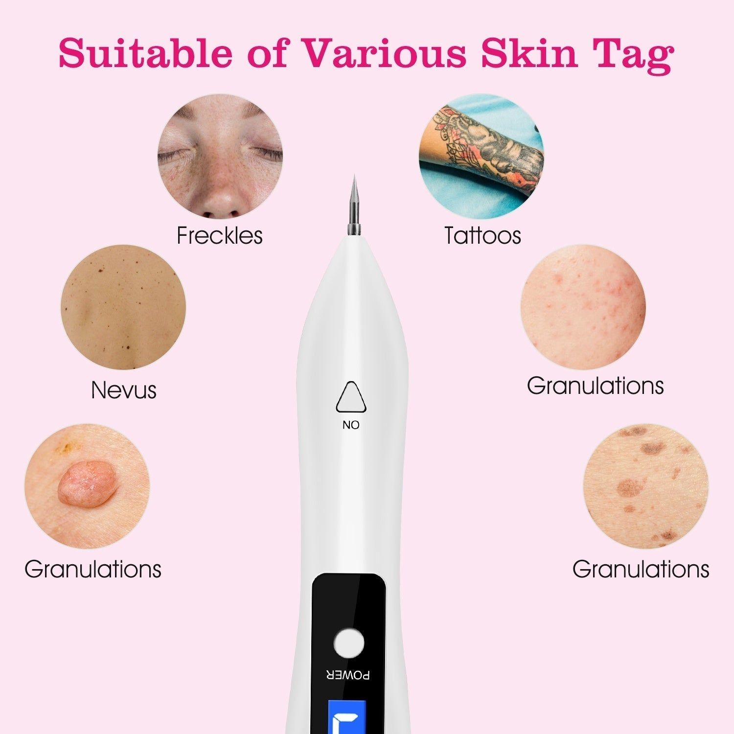 HKM-694099 2-Piece Skin Tag Repair Kit with Adjustable Intensity and Fast Healing Function