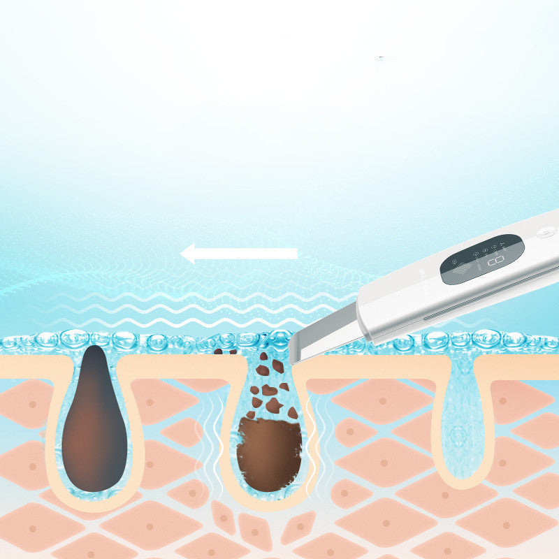HKM-085011 Ultrasonic Facial Cleansing Tool for Blackheads and Acne Removal at Home