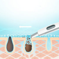 HKM-085011 Ultrasonic Facial Cleansing Tool for Blackheads and Acne Removal at Home