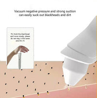 HKM-244883 Black and White Skin Rejuvenation Device with 1080P Visual Blackhead Suction and Air Pump Technology