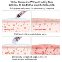 HKM-230739 Portable Oxygen Spray Hydro Jet Face Care Machine for Blackhead Removal and Skin Rejuvenation
