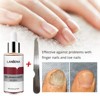 HKM-911187 Nail Repair and Care Essence with Salicylic Acid and Belvedere Fruit Extract - 12ml