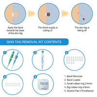 HKM-365331 Skin Removal Pen for Wart, Mole, and Corn Treatment - Versatile Beauty Tool
