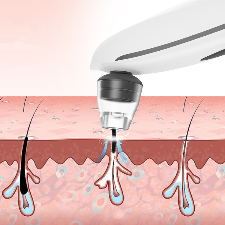 HKM-098515 Electric Blackhead Remover with Negative Pressure and Rotating Function