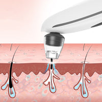 HKM-098515 Electric Blackhead Remover with Negative Pressure and Rotating Function