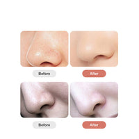 HKM-098515 Electric Blackhead Remover with Negative Pressure and Rotating Function