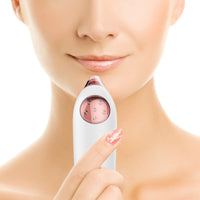 HKM-372499 Electric Blackhead Vacuum Suction Tool, Pore Cleaner and Acne Extractor for Facial Care