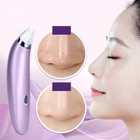 HKM-514451 Electric Blackhead Remover with Rotating Suction Function - Facial Cleansing Tool 180mm x 40mm