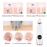 HKM-732307 Facial Cleanser with Vacuum Technology for Blackhead Removal and Pore Tightening