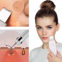 HKM-685523 Ultrasonic Electric Pore Cleansing Device with USB Charging, 172mm Size