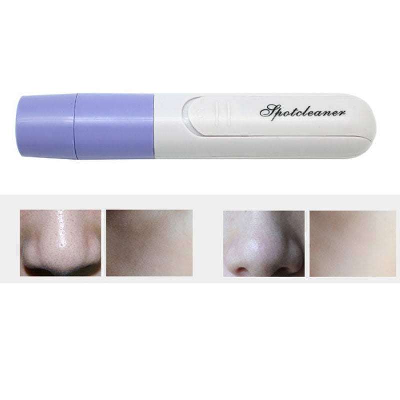 HKM-952787 Electric Pore Cleanser and Facial Massager for Deep Cleansing and Pore Minimization