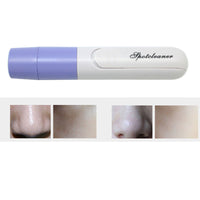 HKM-952787 Electric Pore Cleanser and Facial Massager for Deep Cleansing and Pore Minimization