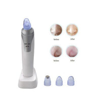 HKM-945875 Rechargeable Electronic Blackhead Remover with 4 Interchangeable Tips and LED Display