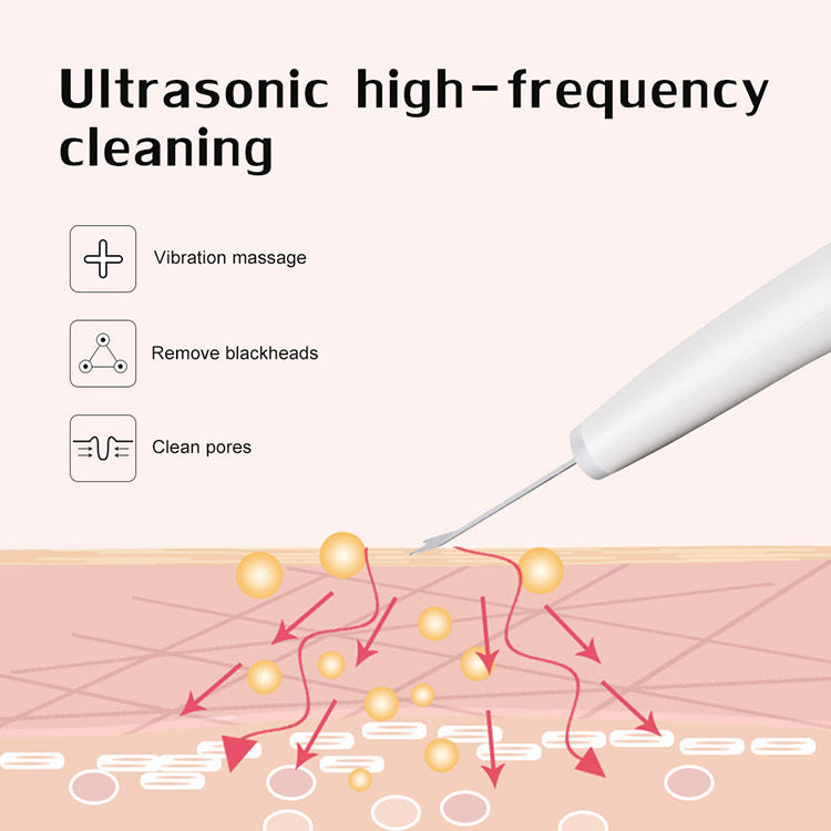 HKM-784979 Ultrasonic Facial Exfoliation Shovel for Home Use - White