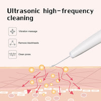 HKM-784979 Ultrasonic Facial Exfoliation Shovel for Home Use - White
