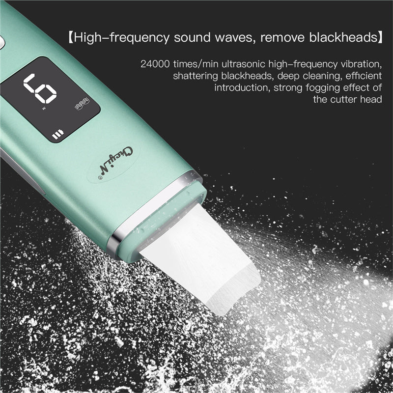 HKM-564051 Ultrasonic Negative Ion Blackhead Vacuum Cleaner with Deep Pore Cleansing and Nano Spray Function
