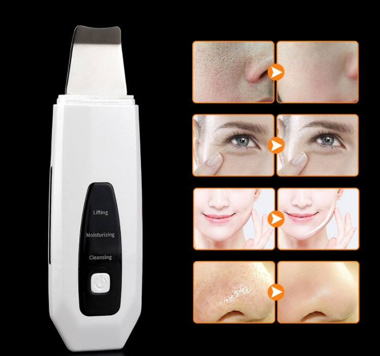 HKM-001363 Ultrasonic Ion Skin Cleanser C-106 for Effective Deep Cleansing and Revitalization
