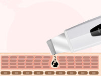 HKM-001363 Ultrasonic Ion Skin Cleanser C-106 for Effective Deep Cleansing and Revitalization