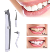 HKM-016659 Sonic Teeth Whitening Kit with LED Light and 4 Interchangeable Grinding Heads for Tartar Removal