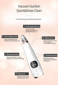 HKM-553299 Blackhead Remover Vacuum with Multiple Tips for Effective Cleansing and Pore Shrinking