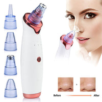 HKM-274195 Ultrasonic Pore Cleansing Beauty Device for Acne Treatment