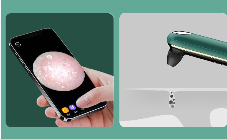 HKM-521683 Wireless Blackhead Removal Device with Visual Feedback and Electric Rotation